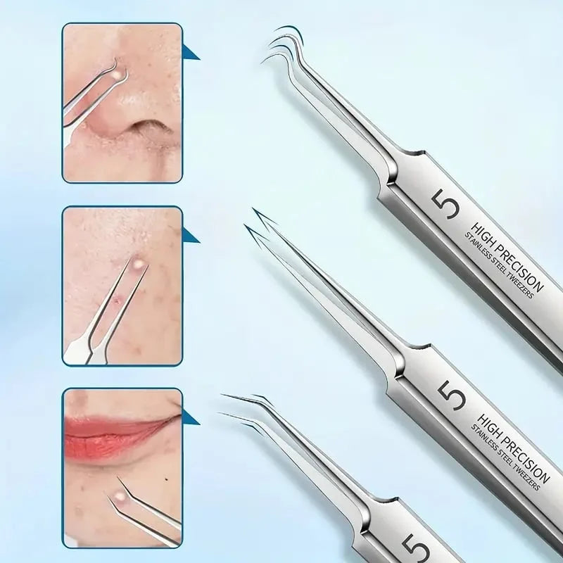 Proffsig Blackhead Borttagare