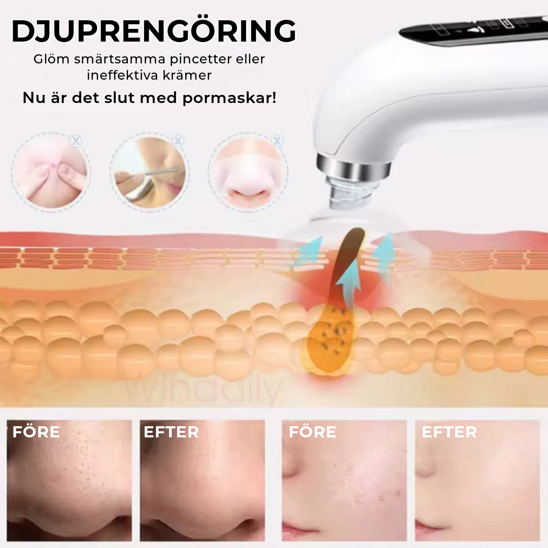 PureSkin™