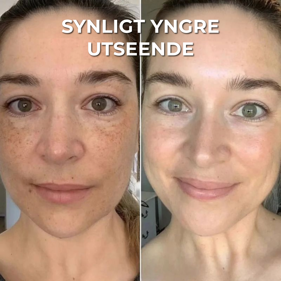 Lumeor™ Kollagenmask