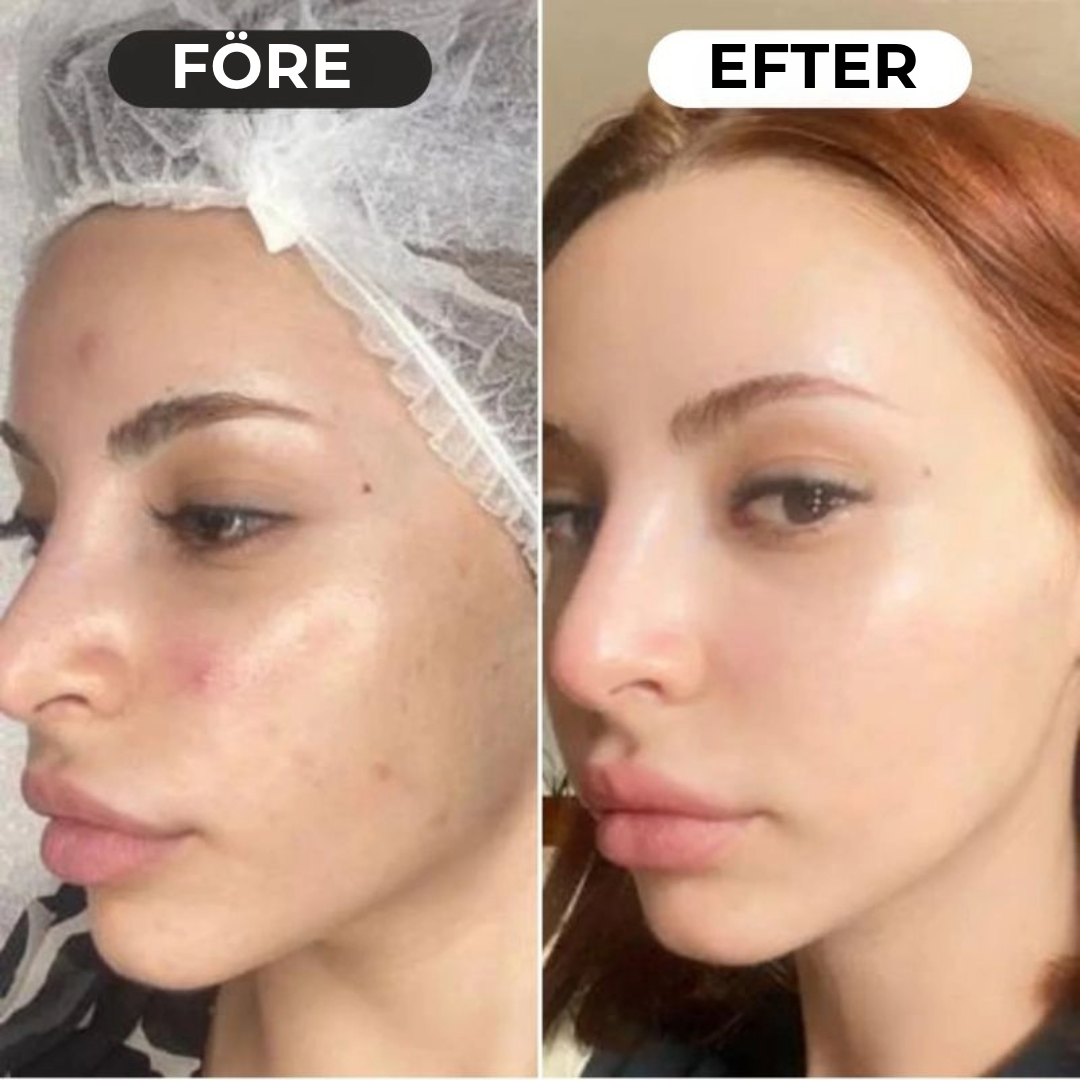 Lumeor™ Kollagenmask