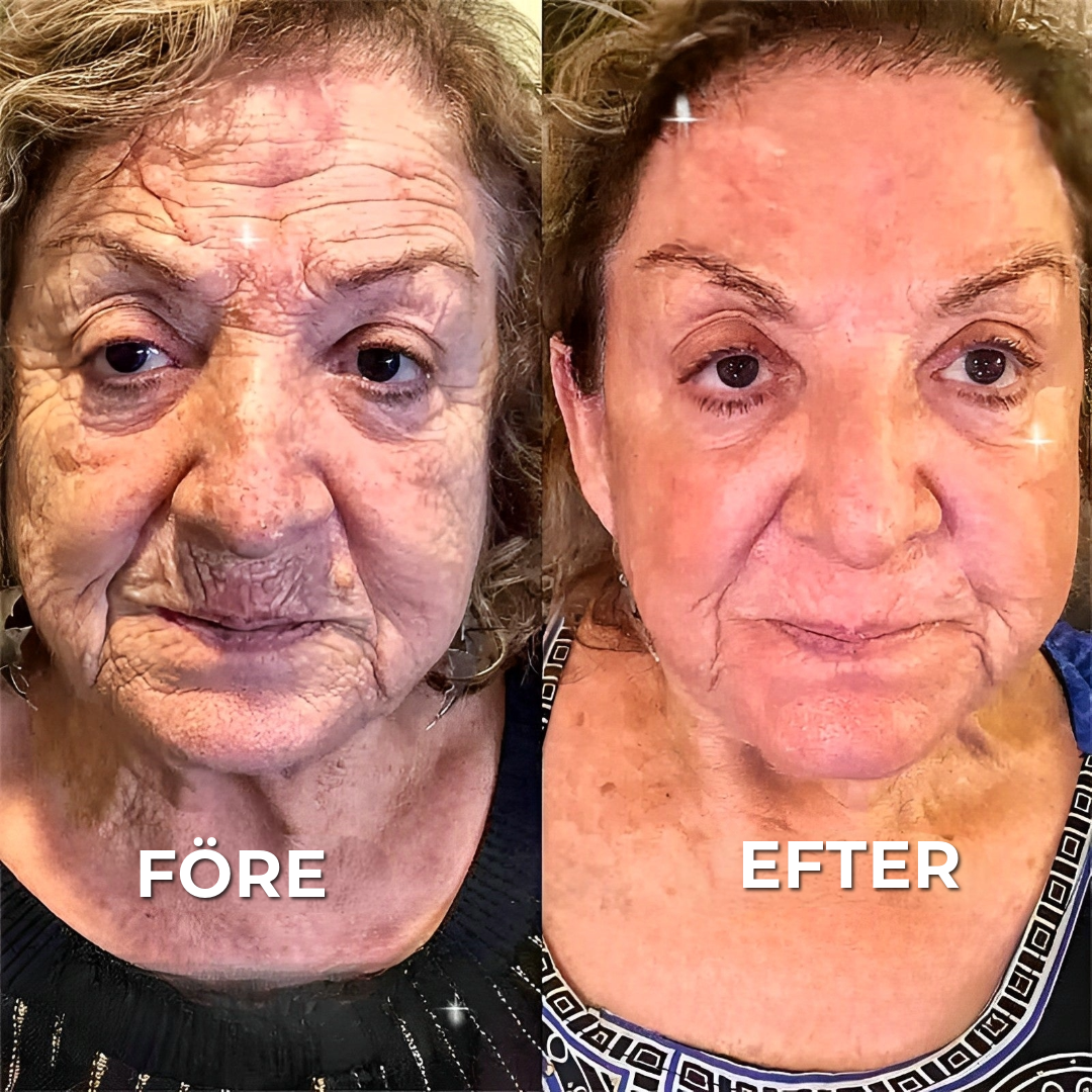 BOTOX™ Anti-rynkkräm
