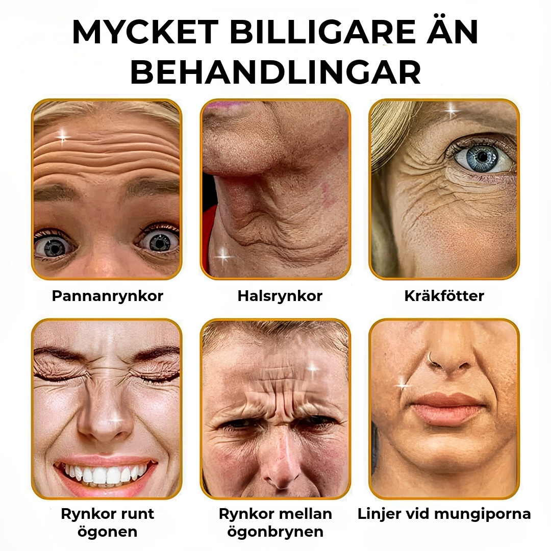 BOTOX™ Anti-rynkkräm