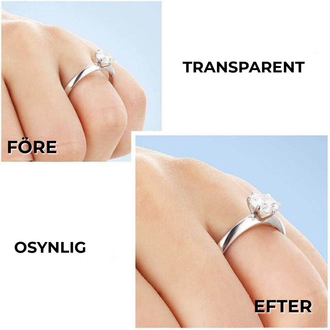 RingFix™ | ringförminskare