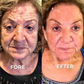 BOTOX™ Anti-rynkkräm