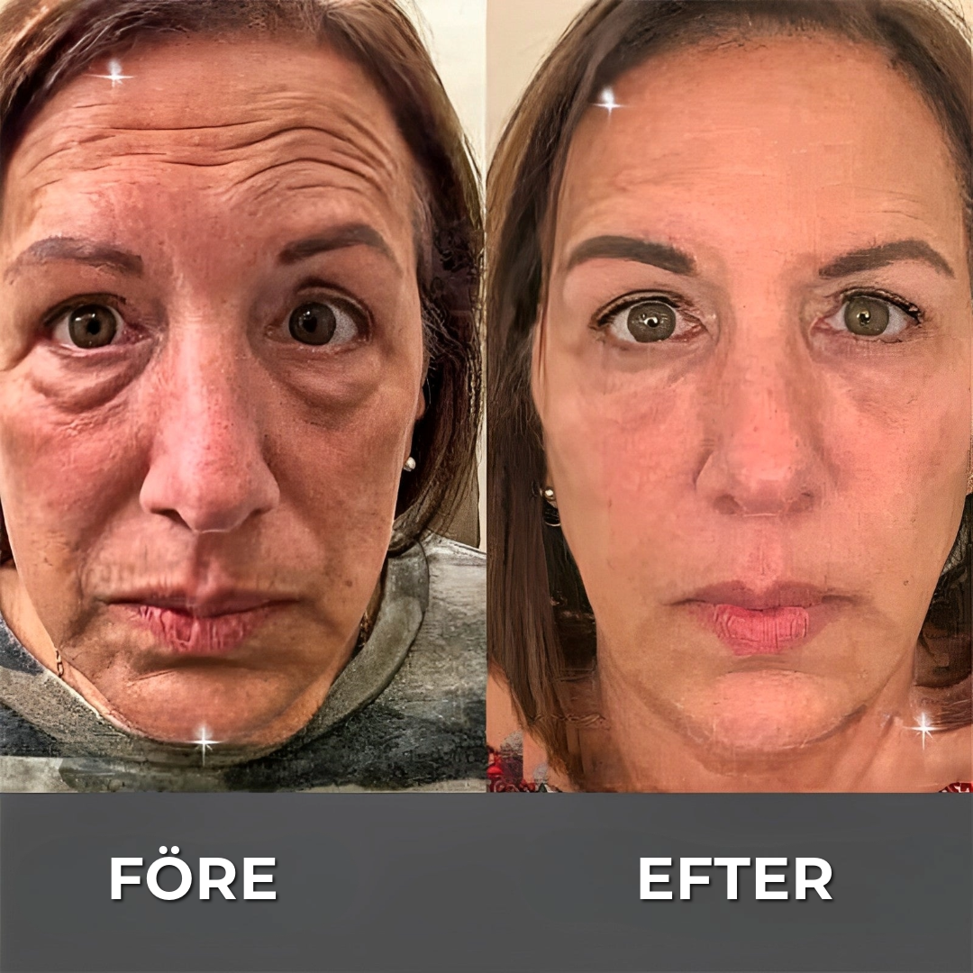 BOTOX™ Anti-rynkkräm