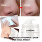 LANBENA™ Blackhead Ansiktsmask 60 Stycken