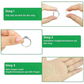 RingFix™ | ringförminskare